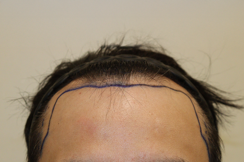 포토후기 이미지