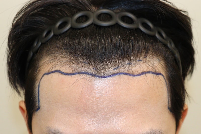 수술전2.jpg