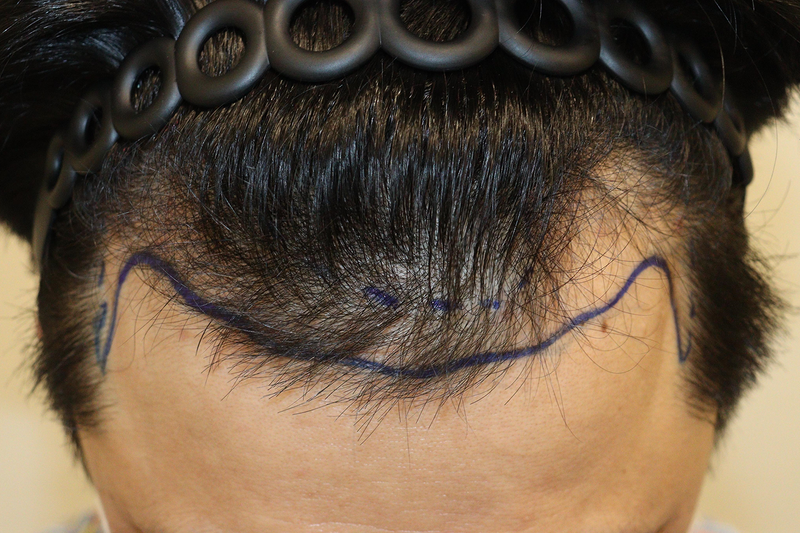 포토후기 이미지