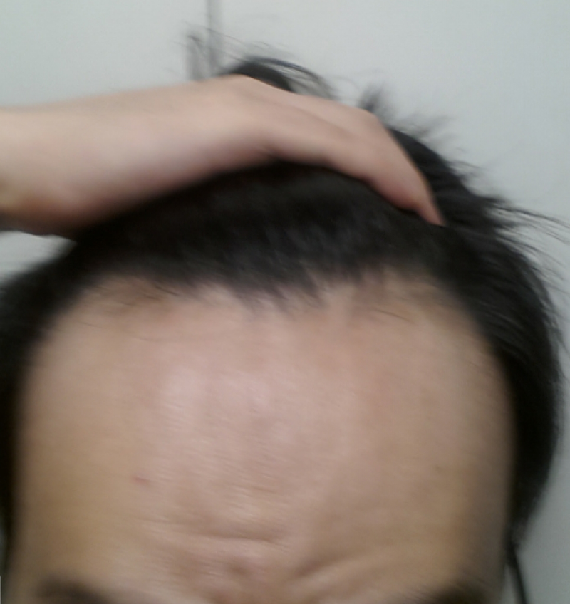 0_IMG_20150728_1.png
