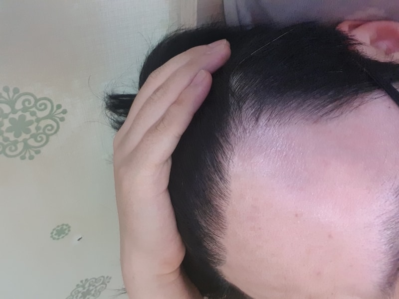 20180812_181751.jpg