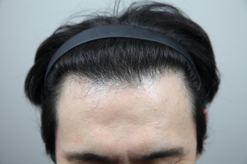 포토후기 이미지