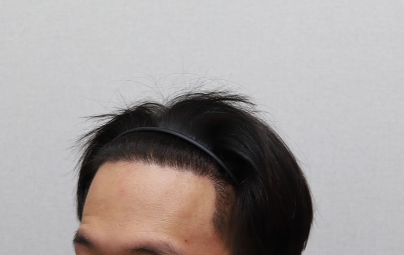6개월 좌측상단.JPG