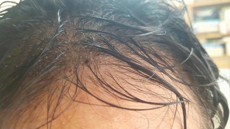 20170803_143827_resized.jpg