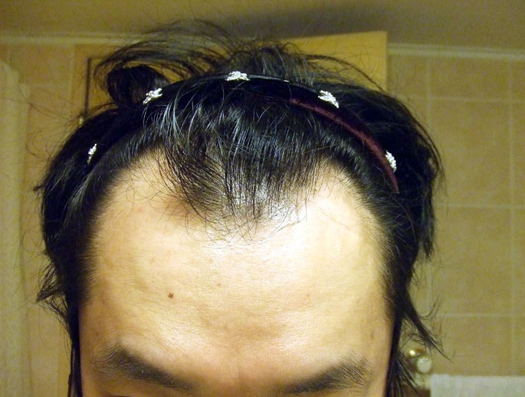 DSCF38531.jpg