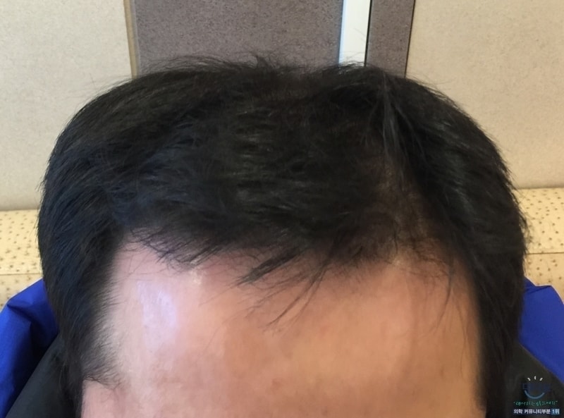 image_04_수술전.jpg