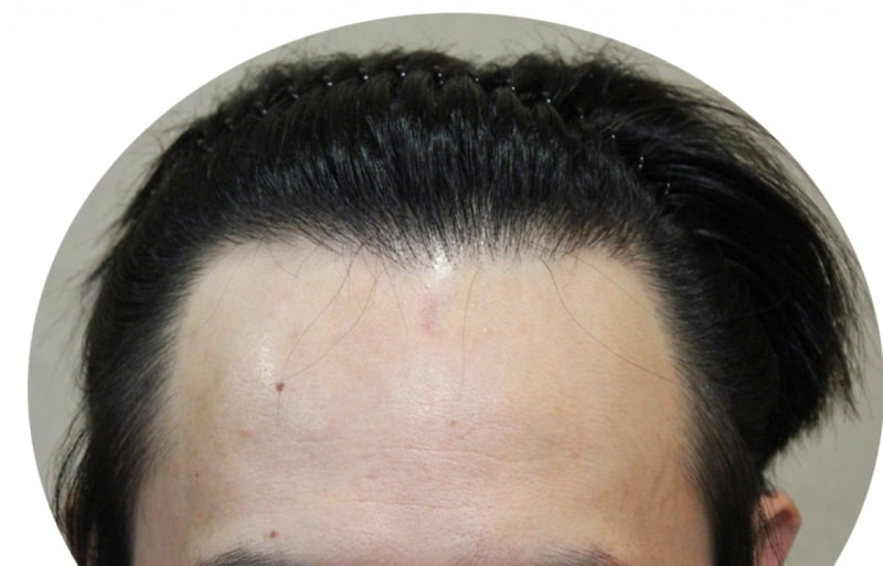 수술후.jpg