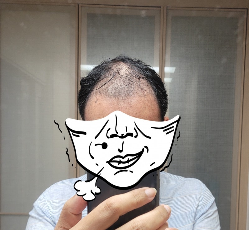 Non-cut 4500 Mo 3 months review