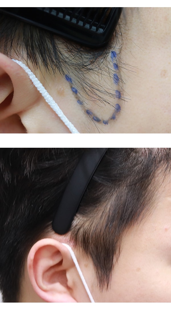 구레나룻2.jpg