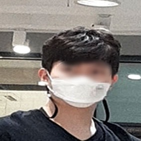 6개월경과후-나3.jpg