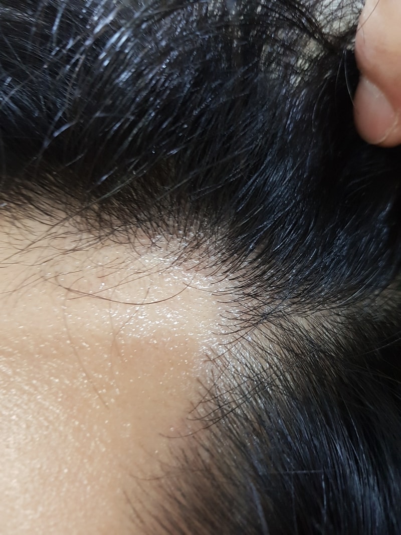 8-9个月后期