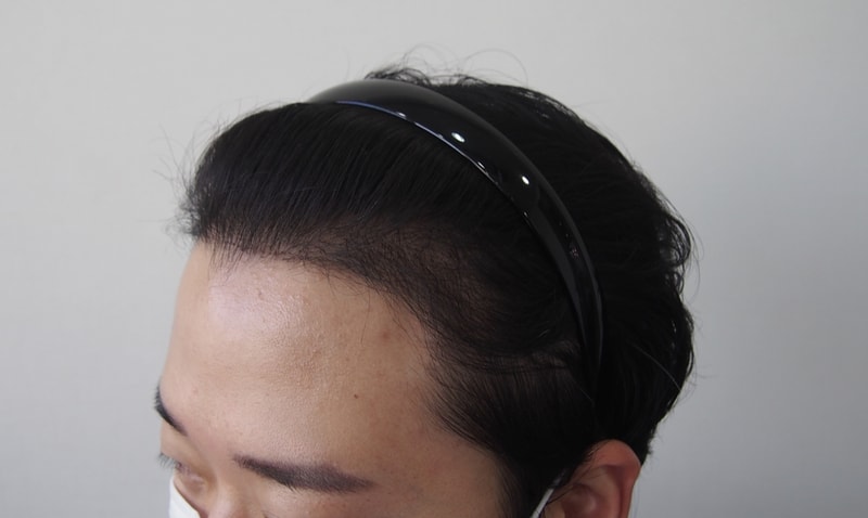 移植4か月目