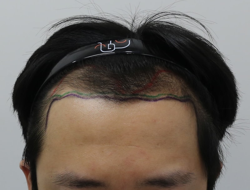 포토후기 이미지