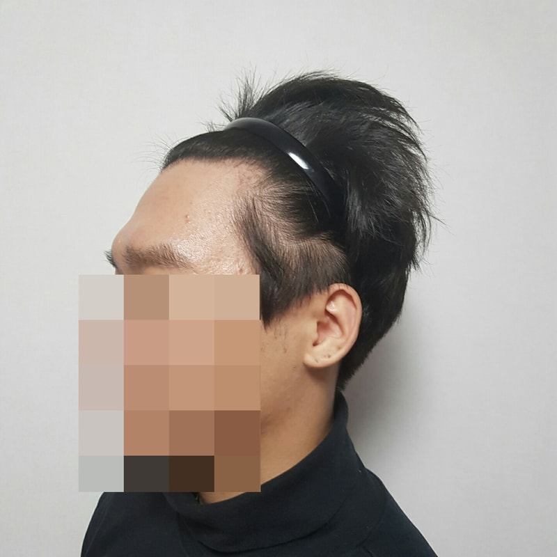 전 좌.jpg