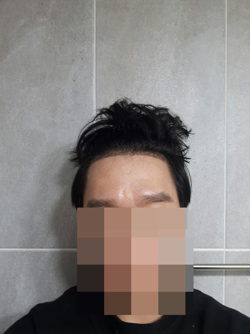후 전.jpg