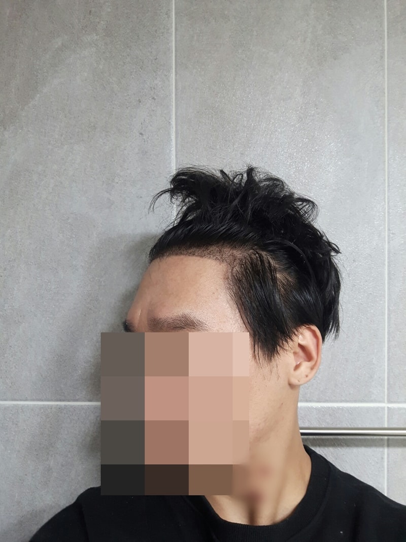후 좌.jpg