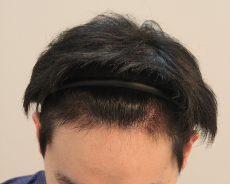 4개월1.JPG