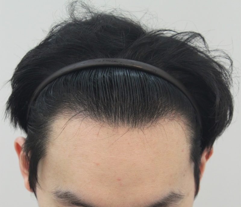 수술전1.JPG