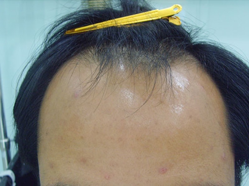 SNV35864.jpg