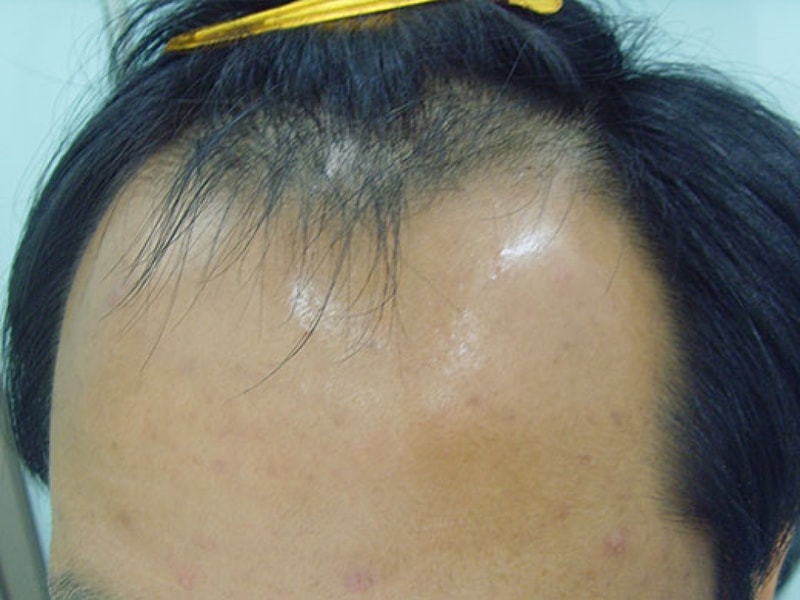 SNV35865.jpg
