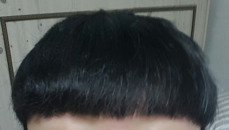 移植1年10ヶ月目です 素直後記
