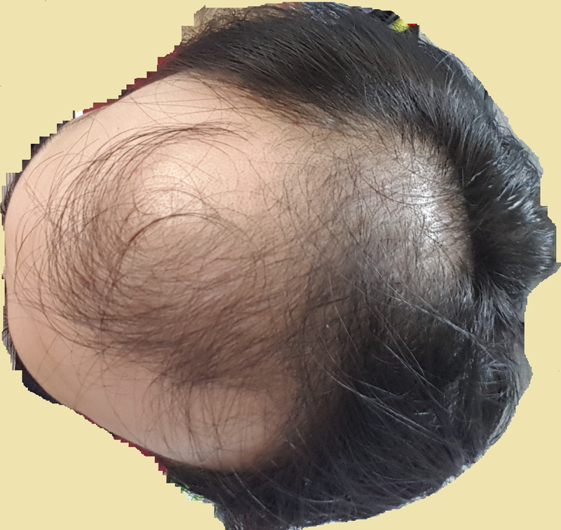 f.png