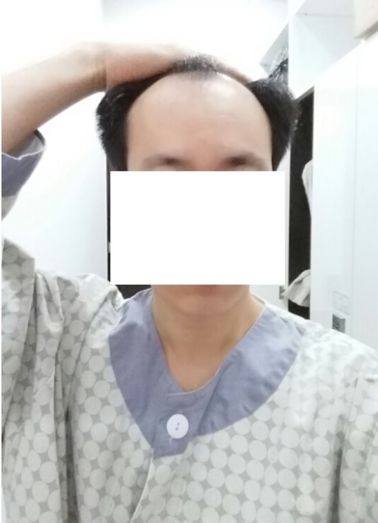 수술전_모자이크01.jpg