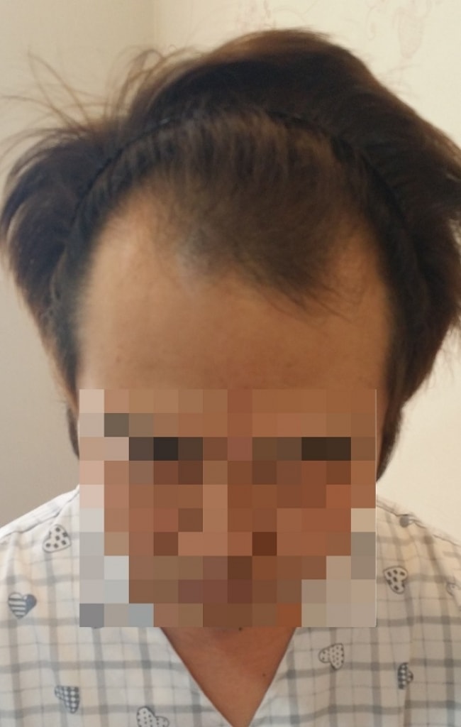 수술전.jpg
