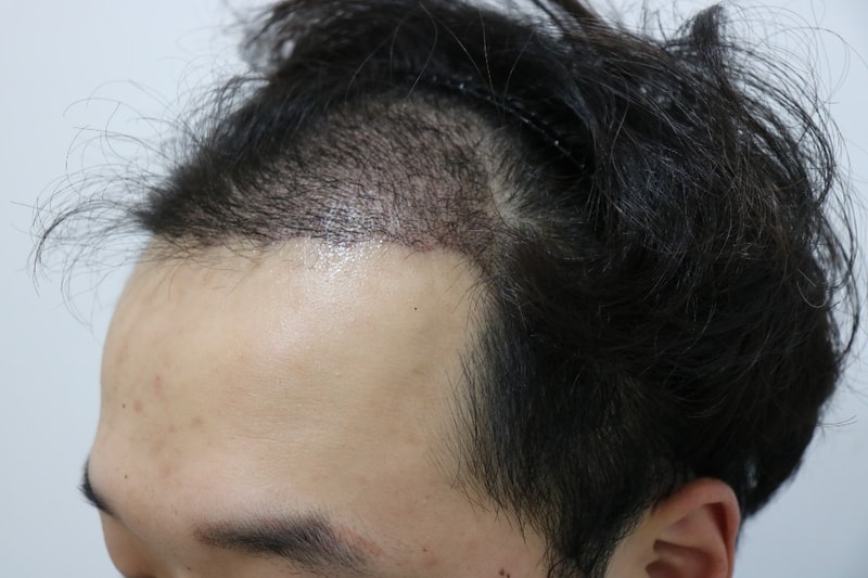 수술후1.jpg