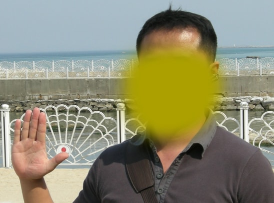 수술후전체.jpg