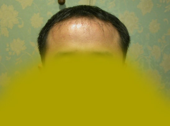 수술전전체.jpg