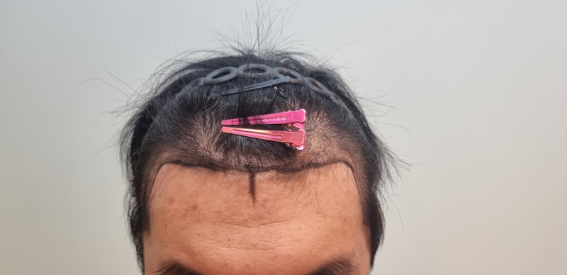 1000003697.jpg