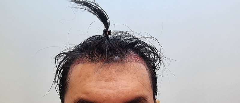 1000003702.jpg