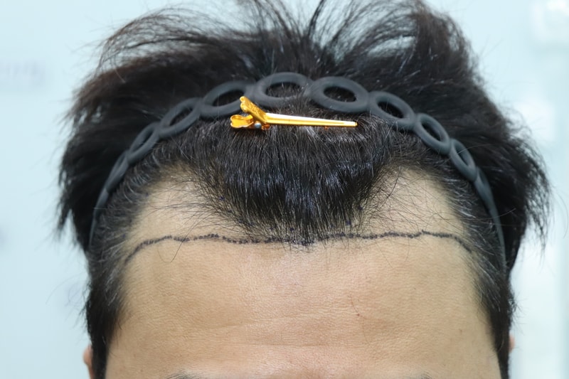 KakaoTalk_20220305_160157881_01.jpg