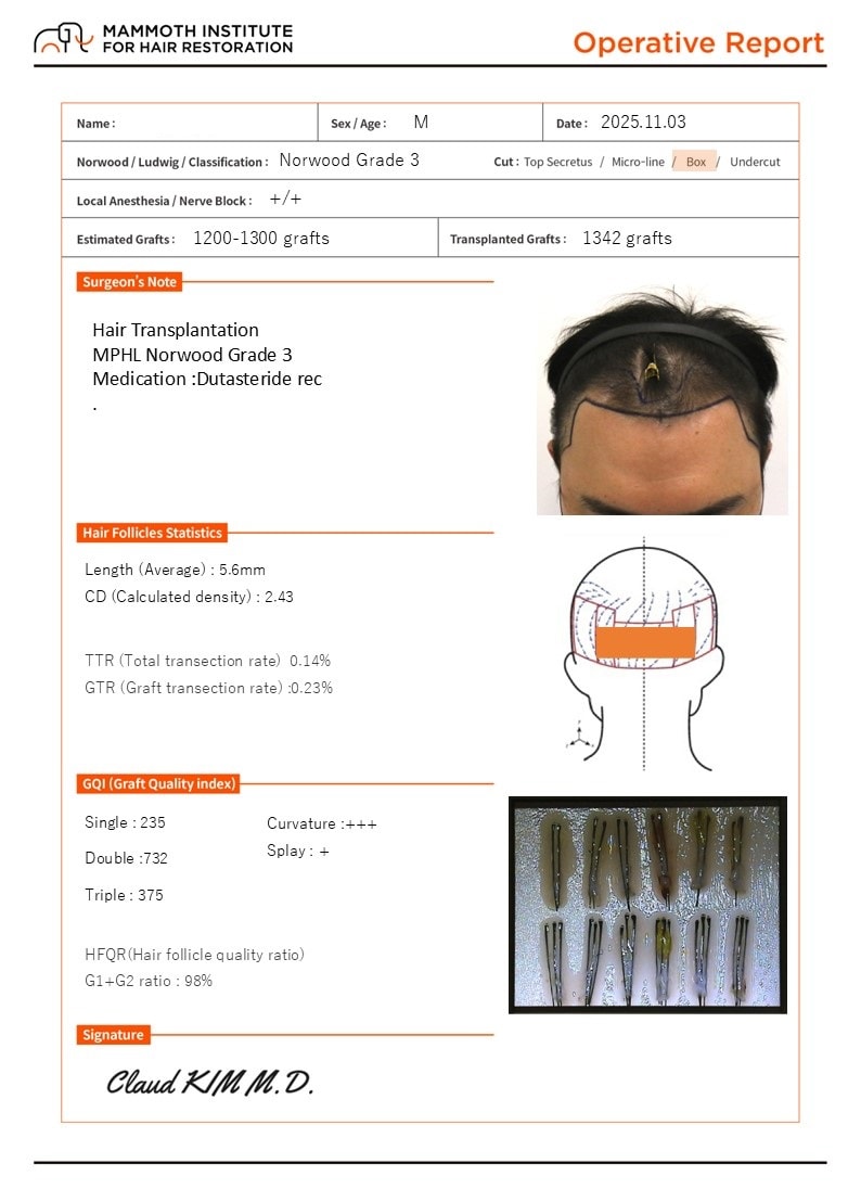 Busan Hair Transplantation Slit Method Mammoth M-shaped Surgery Day Review