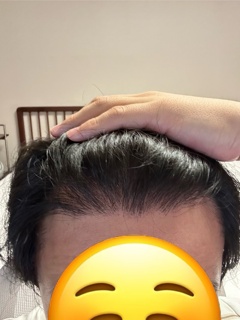<1 year and 2 months review> Kim Jin-oh, the director of the Gangnam branch of New Hair, 2200 Mo, 1 year and 2 months review