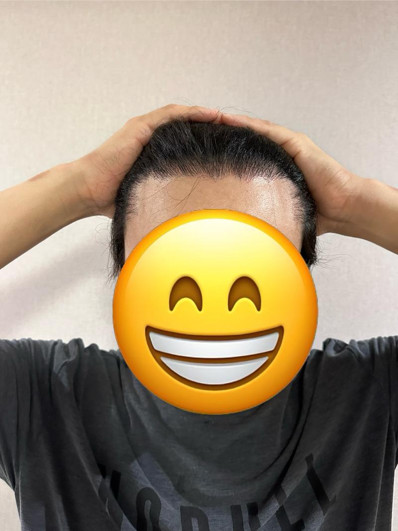<9 months review> Director Kim Jin-oh of Gangnam branch of New Hair 2200 Mo 9 months review