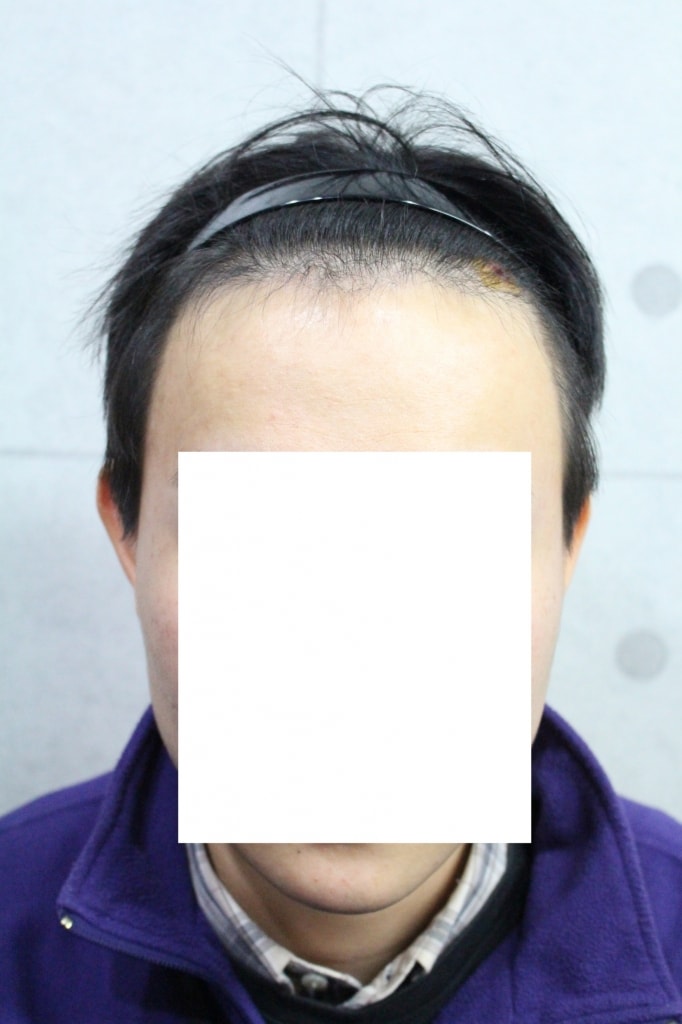 크기변환_IMG_3663.JPG