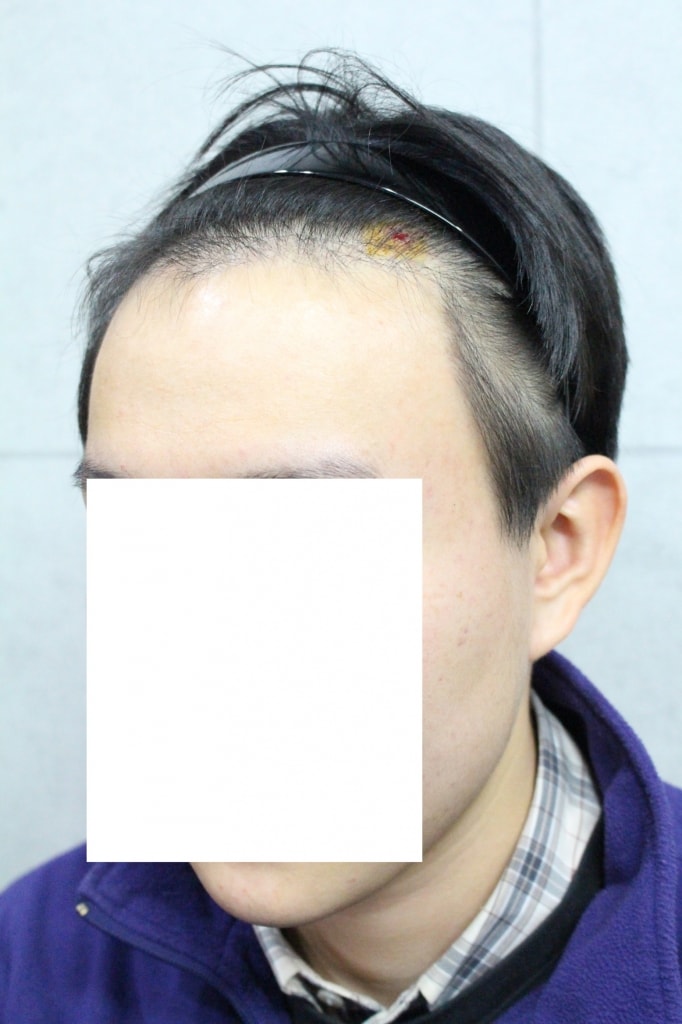 크기변환_IMG_3665.JPG