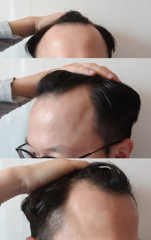 비포.png