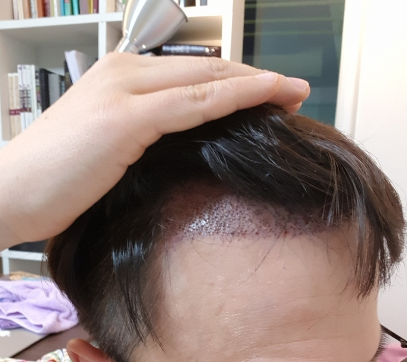 애프터3.png