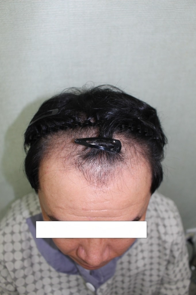 첫번째.jpg