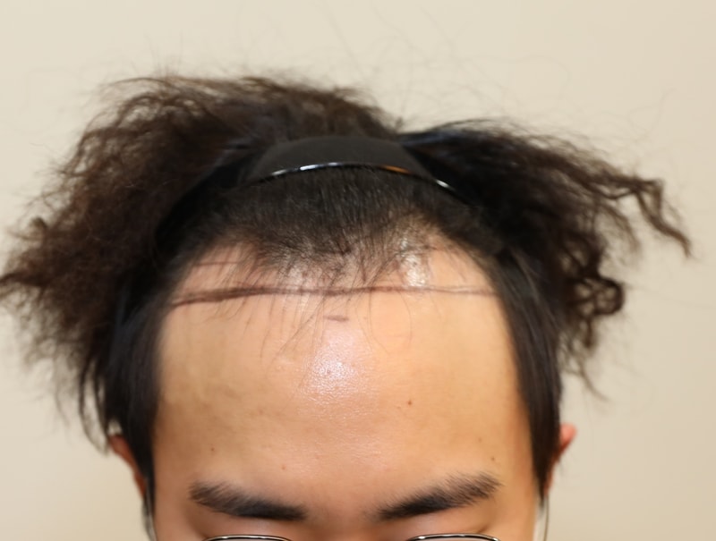 수술전 2.jpg
