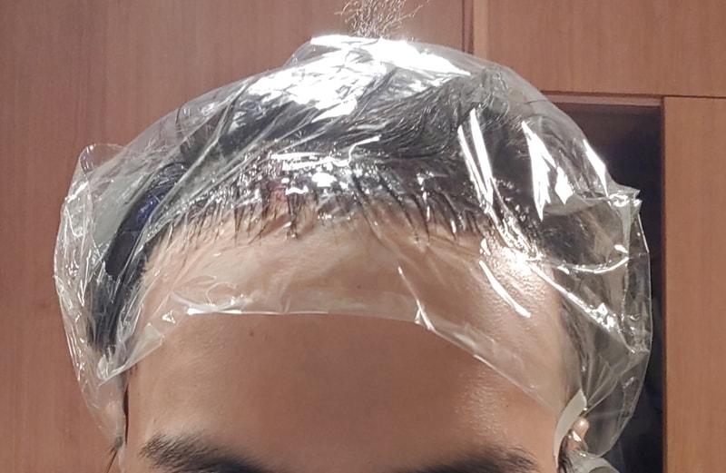 수술 당일 1.jpg
