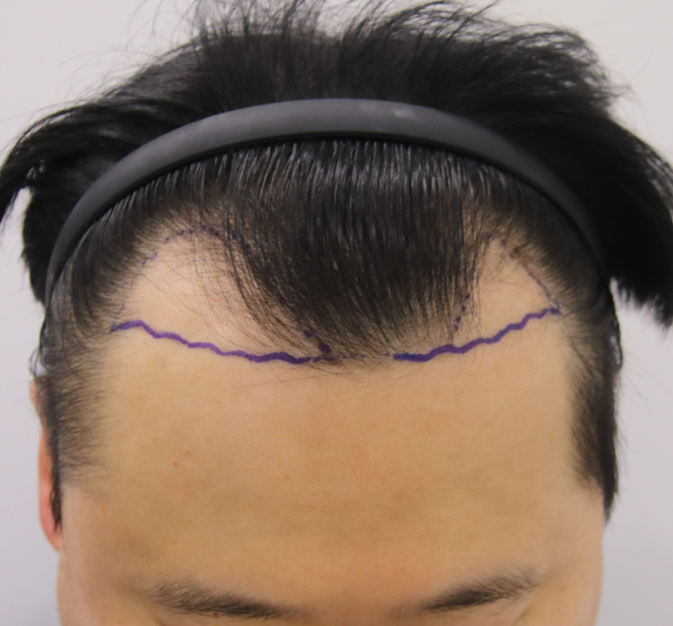 345B1E5C-4915-4C25-B1B6-F3F1FC204164.png