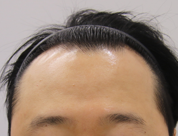 5CFF226B-0EF8-443D-884F-05BFA1C50C6A.png