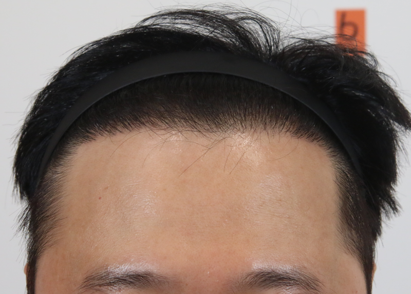 3199599B-FAF3-4E1D-A83B-84BD80981A9A.png