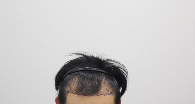 디자인 후.jpg