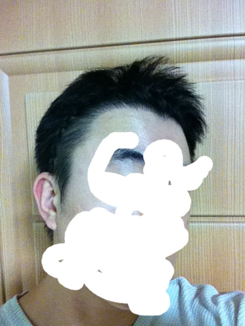9개월 우측.jpg