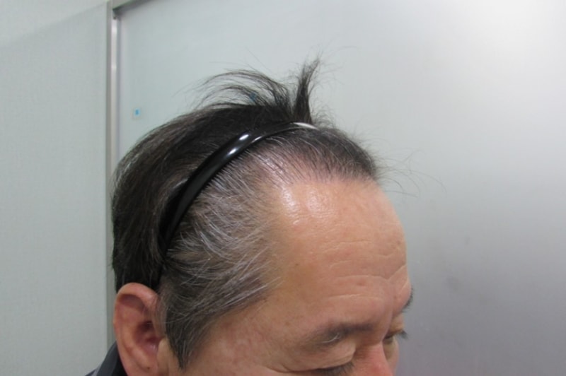 현제옆모습.jpg